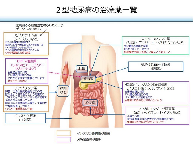 arteriosclerosis28.jpg