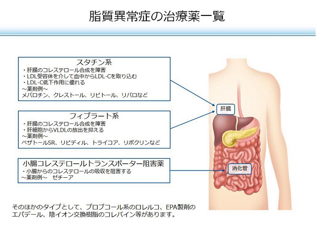 arteriosclerosis40.jpg