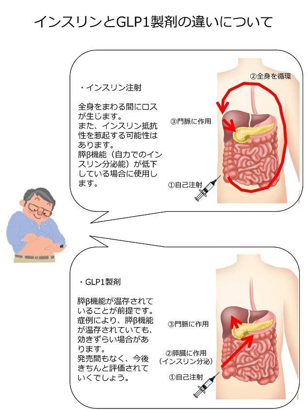 arteriosclerosis24.jpg